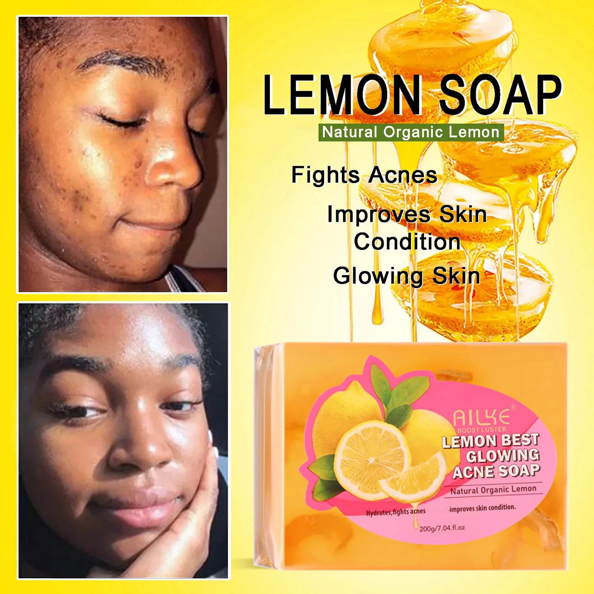 Ailke Natural Skin Brightening Cream For Dark Spots