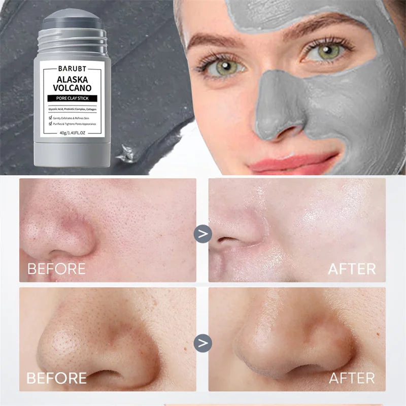Yocity Mugwort Facial Mask For Deep Pore Cleansing And Hydration